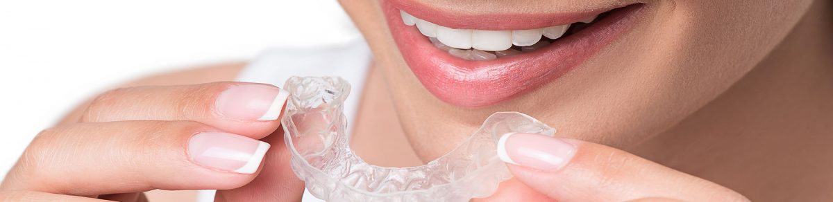 Invisalign braces