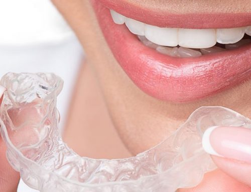 Invisalign Near Me