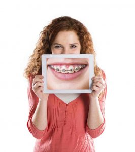 braces, dental braces, Invisalign, orthodontist