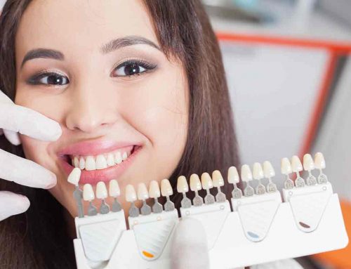 Cosmetic Dentist In Newmarket